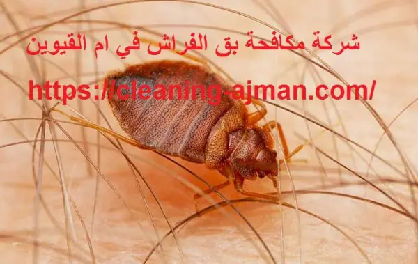 شركة مكافحة بق الفراش في ام القيوين